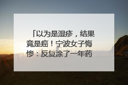 以为是湿疹，结果竟是癌！宁波女子悔惨：反复涂了一年药膏都没好！很多患者首诊都去了皮肤科